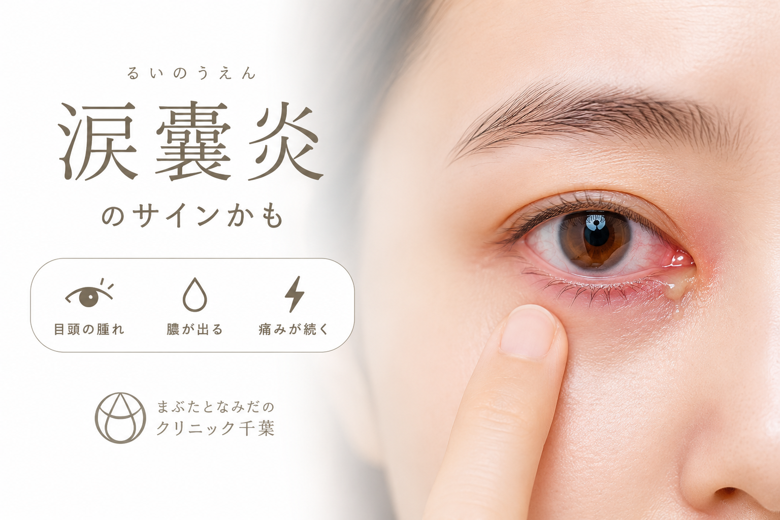 それは涙嚢炎のサインかもしれません。